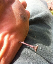 Injury strikes – a huge blackthorn Injury strikes – a huge blackthorn
